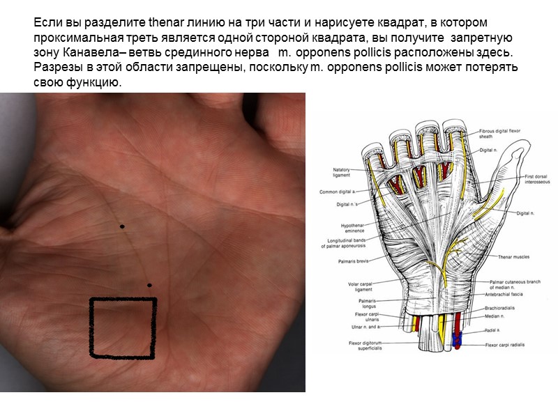 Если вы разделите thenar линию на три части и нарисуете квадрат, в котором проксимальная